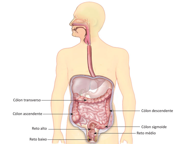 Tudo o que você precisa saber sobre a hérnia inguinal - Dr. Douglas Bastos  – Cirurgia do Aparelho Digestivo │Hepatobiliar