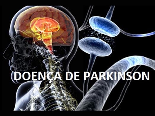 O Que é A Doença De Parkinson Juiz De Fora Mg