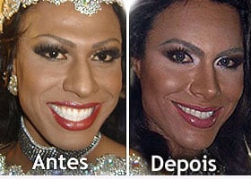 Foto de antes e depois da Miss ES